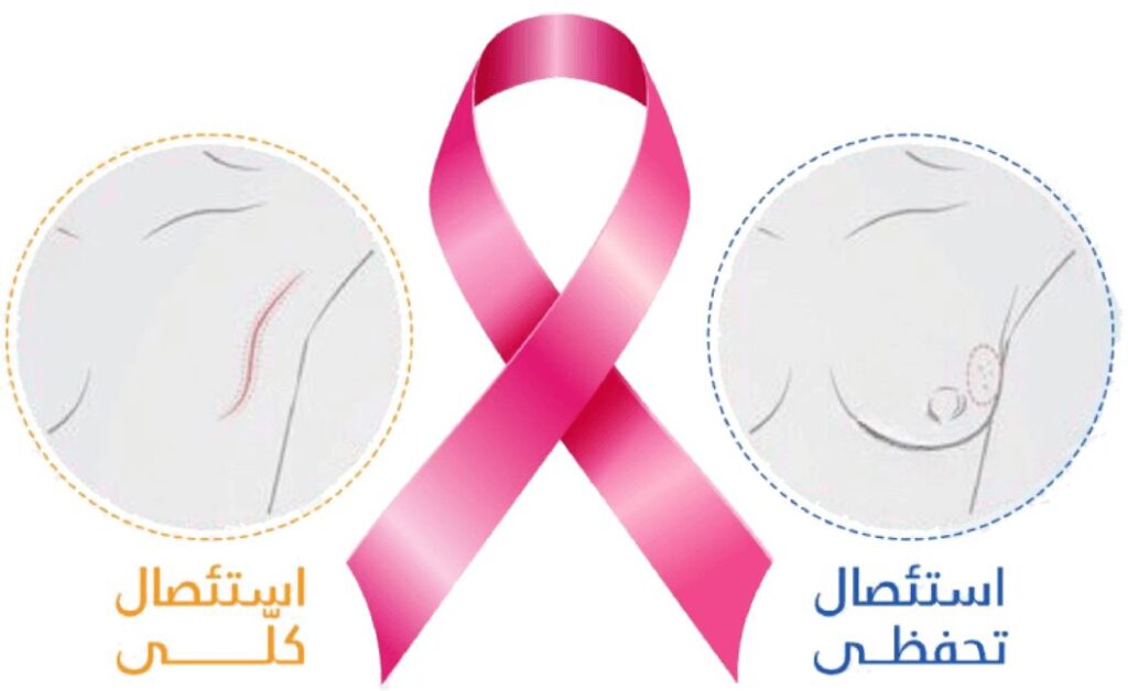 العلاج الجراحي لسرطان الثدي