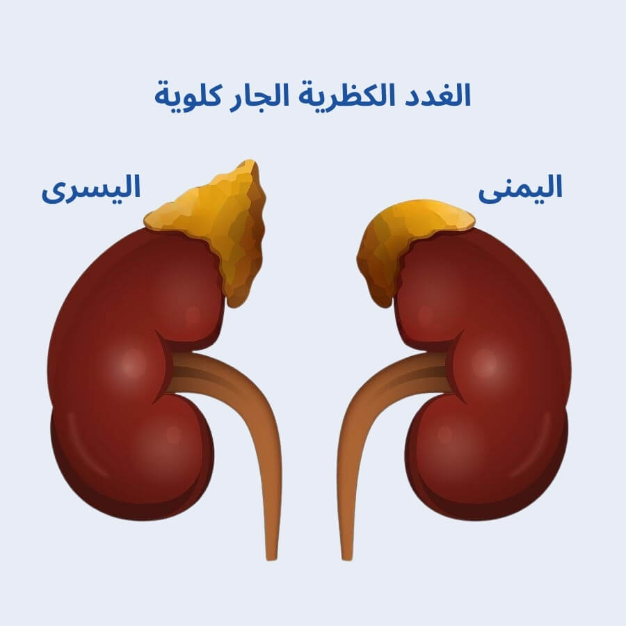 الغدة الكظرية الجار كلوية