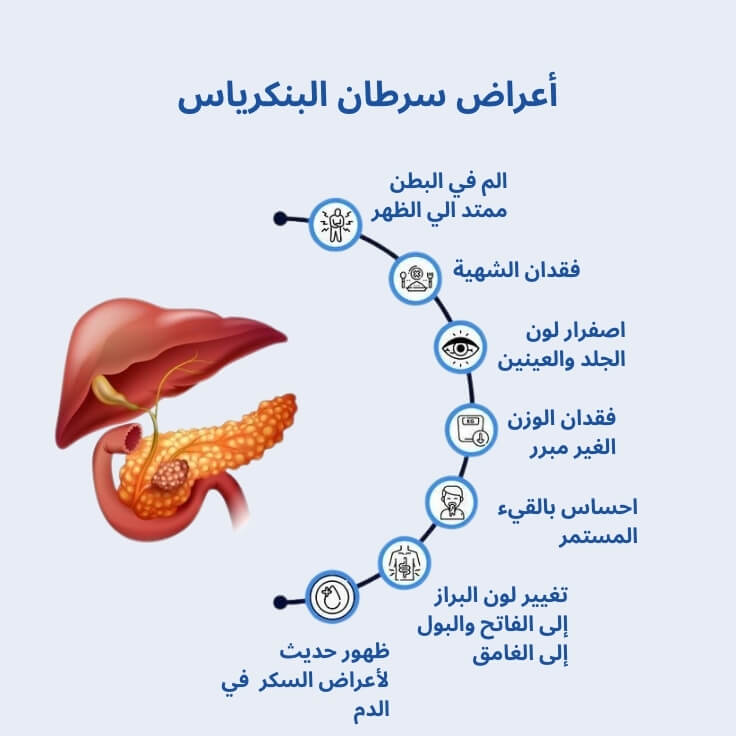 أعراض سرطان البنكرياس