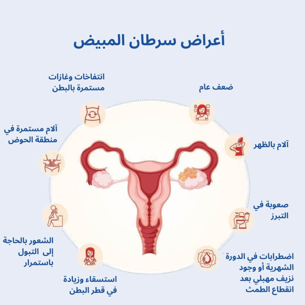 أعراض سرطان المبيض